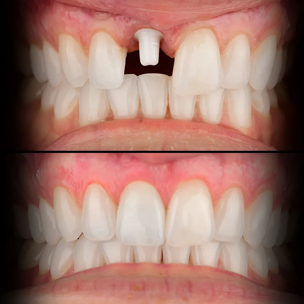Natural Dentistry: Holistic Dentist for Mercury-Safe Care and Laser Dentistry — image 1