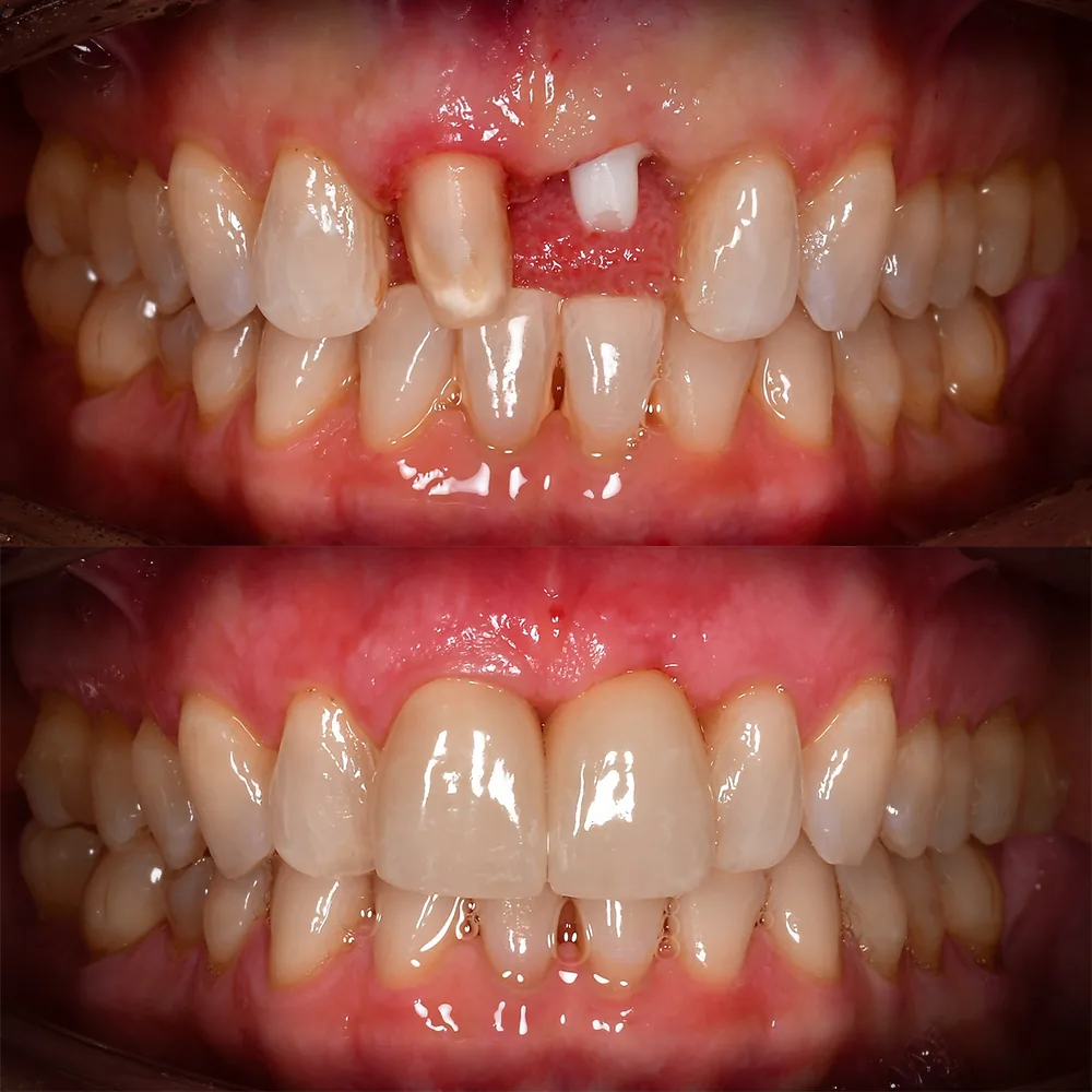 Natural Dentistry: Holistic Dentist for Mercury-Safe Care and Laser Dentistry — image 10