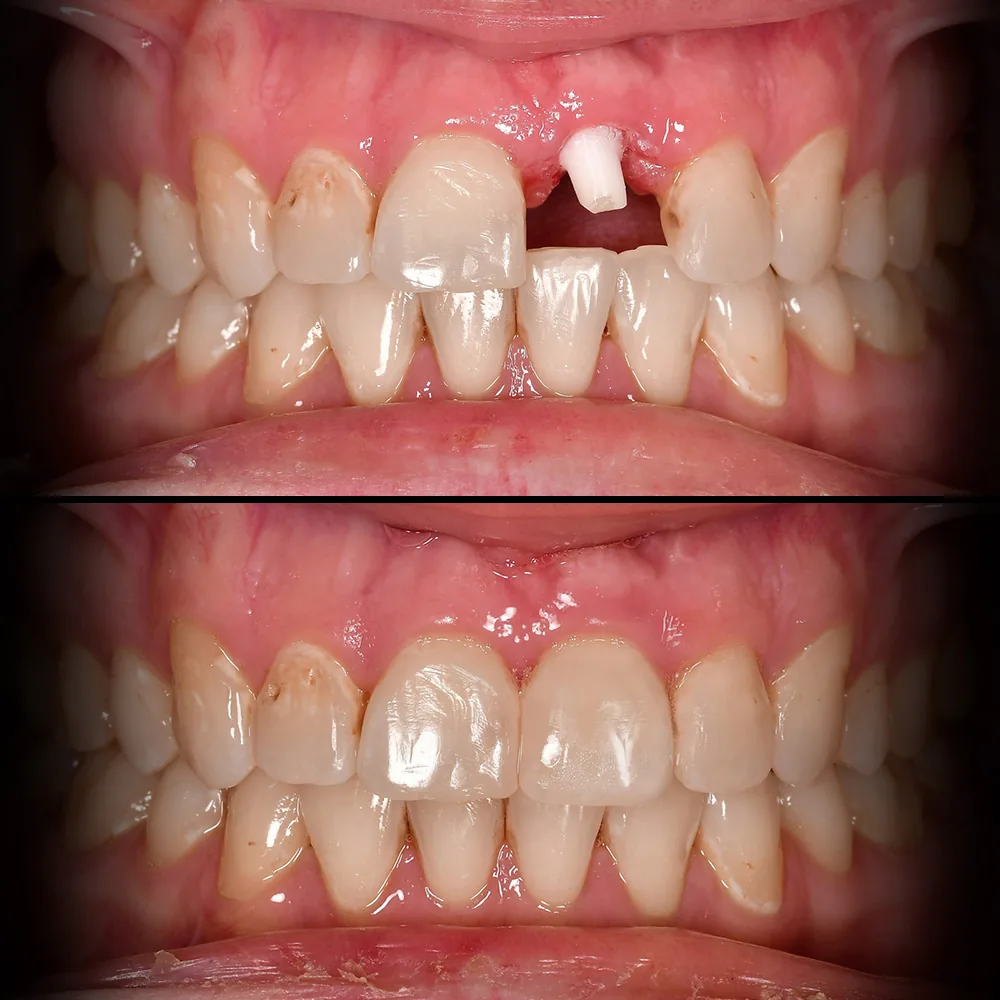 Natural Dentistry: Holistic Dentist for Mercury-Safe Care and Laser Dentistry — image 11