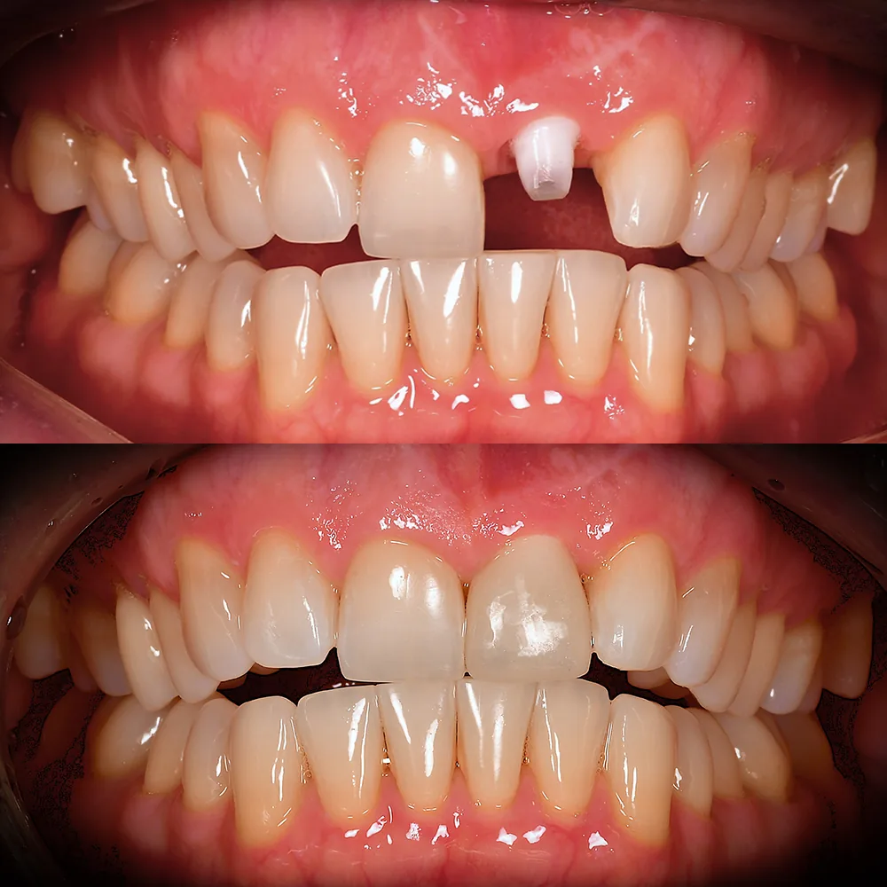 Natural Dentistry: Holistic Dentist for Mercury-Safe Care and Laser Dentistry — image 12