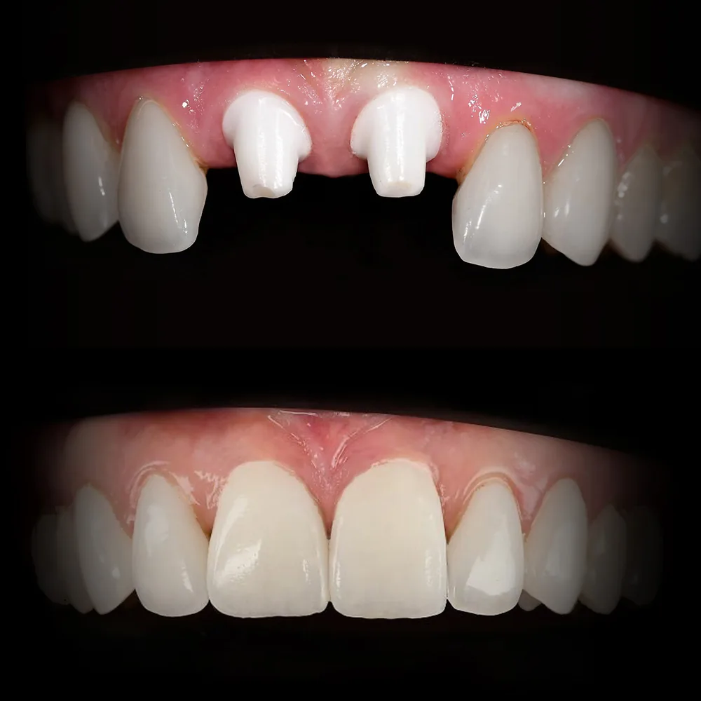 Natural Dentistry: Holistic Dentist for Mercury-Safe Care and Laser Dentistry — image 16