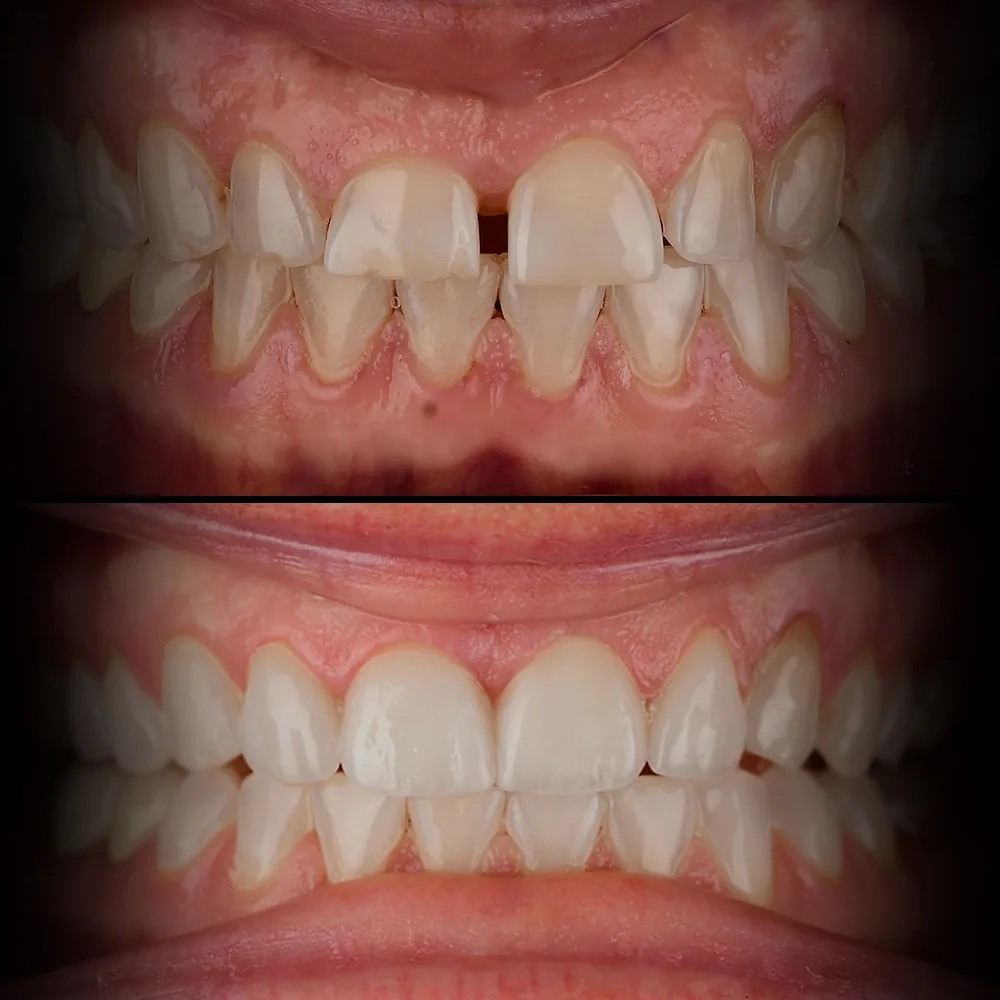 Natural Dentistry: Holistic Dentist for Mercury-Safe Care and Laser Dentistry — image 17