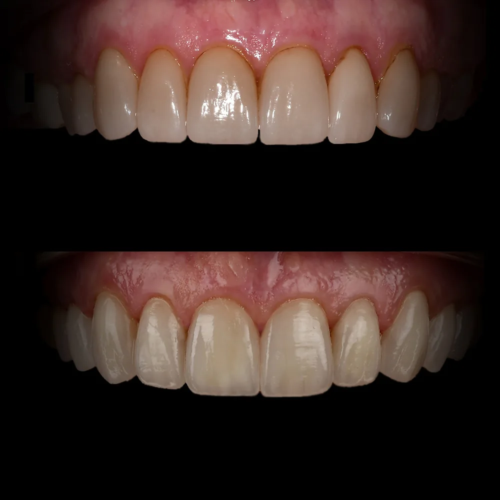 Natural Dentistry: Holistic Dentist for Mercury-Safe Care and Laser Dentistry — image 18
