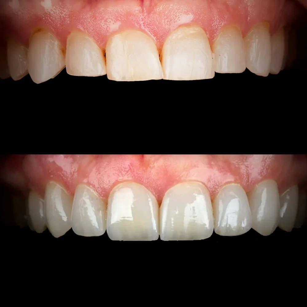 Natural Dentistry: Holistic Dentist for Mercury-Safe Care and Laser Dentistry — image 19