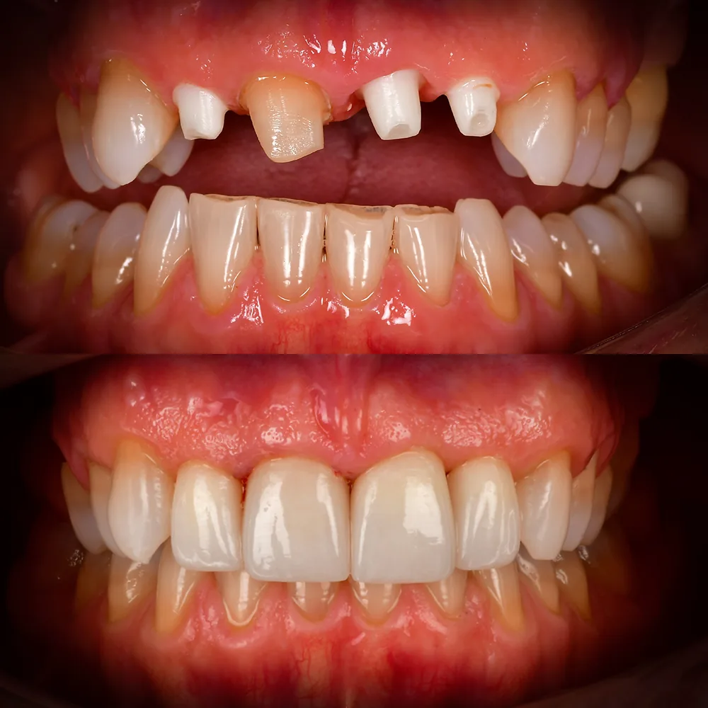 Natural Dentistry: Holistic Dentist for Mercury-Safe Care and Laser Dentistry — image 2