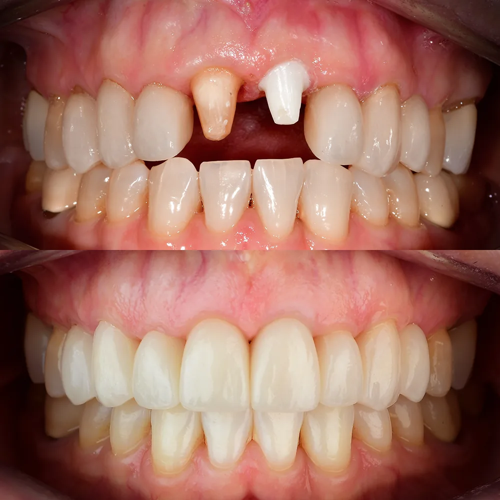 Natural Dentistry: Holistic Dentist for Mercury-Safe Care and Laser Dentistry — image 3