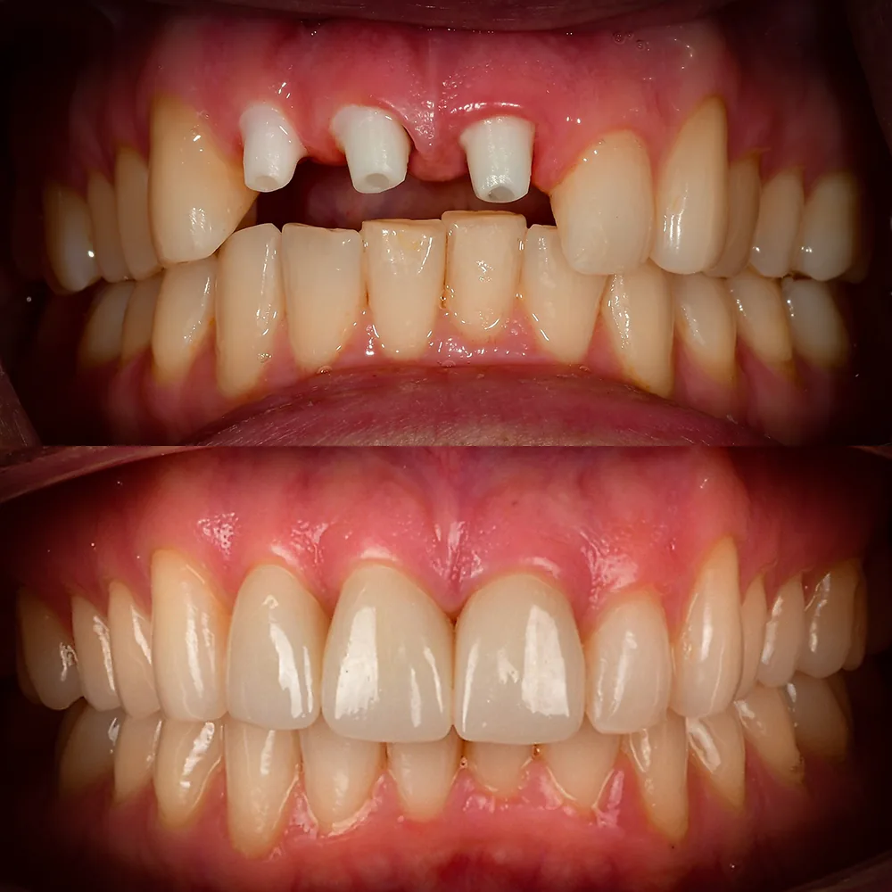 Natural Dentistry: Holistic Dentist for Mercury-Safe Care and Laser Dentistry — image 5