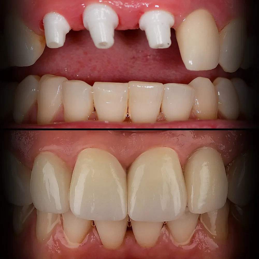 Natural Dentistry: Holistic Dentist for Mercury-Safe Care and Laser Dentistry — image 6
