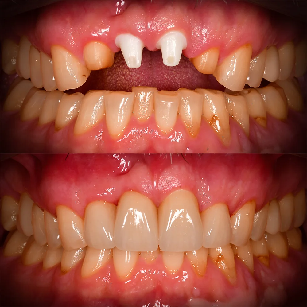 Natural Dentistry: Holistic Dentist for Mercury-Safe Care and Laser Dentistry — image 7