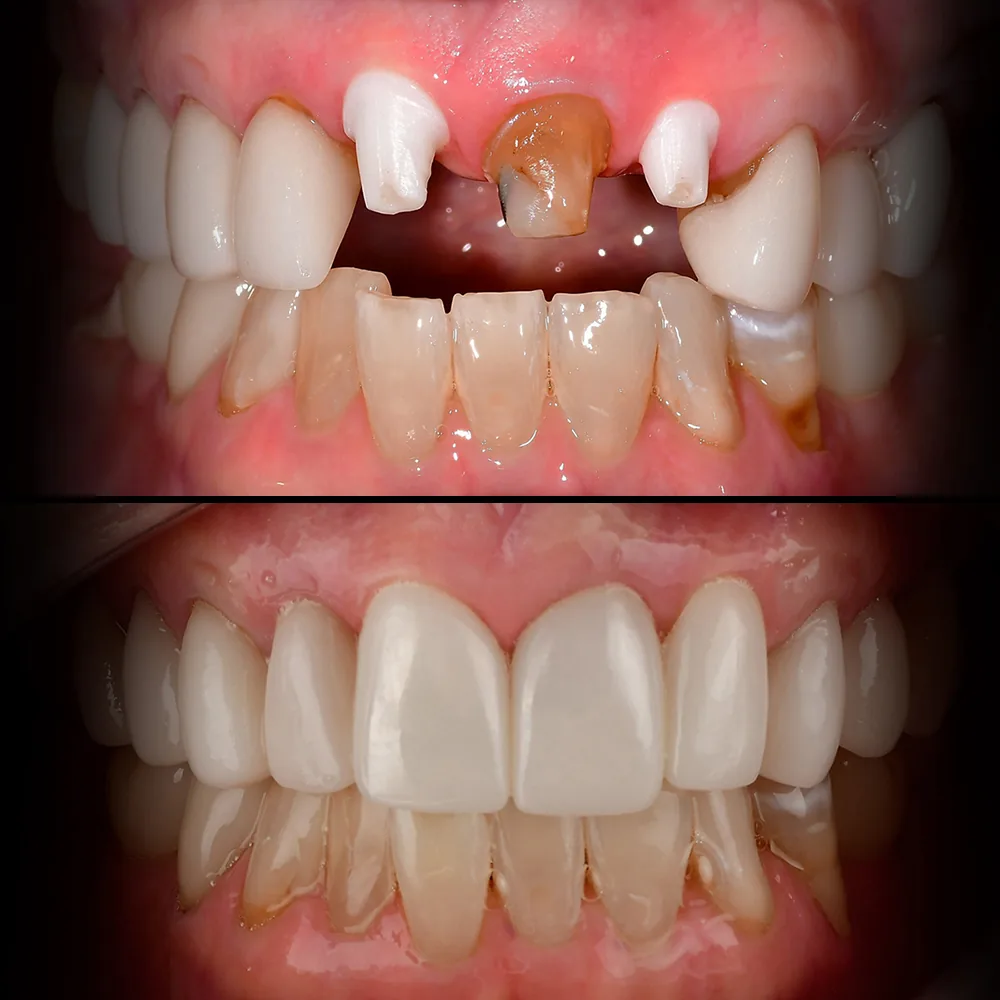 Natural Dentistry: Holistic Dentist for Mercury-Safe Care and Laser Dentistry — image 9
