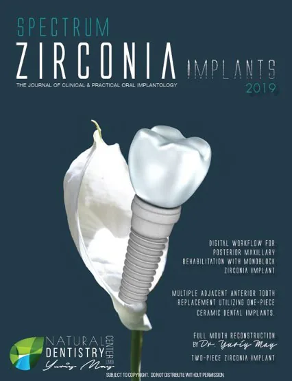 Natural Dentistry: Spectrum Zirconia Implants 2019